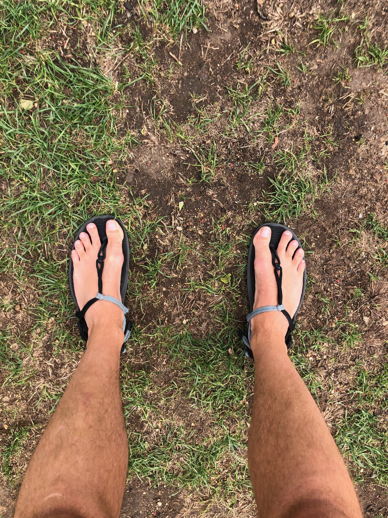 Blog | I Healed My Bunions Without Surgery 👣